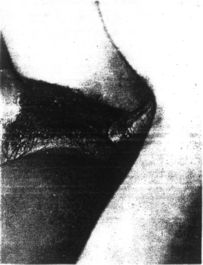 Man Ray